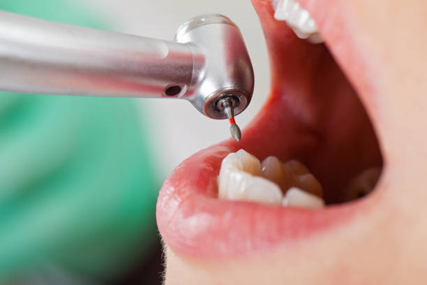 Best Emergency Dental Care for Trauma or Injury in Deerfield, MI